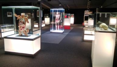 Plastination